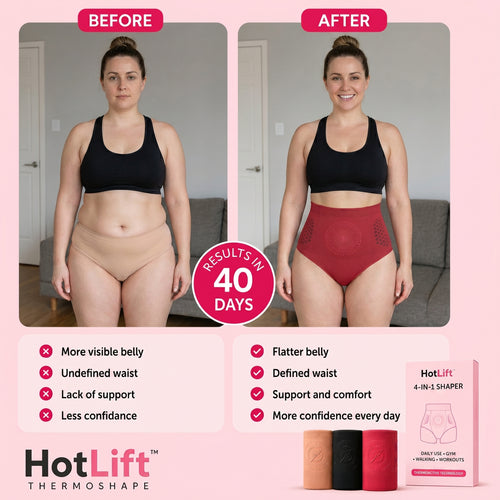 HotLift™ ThermoShape — Sauna-Effect Shorts with Thermal Compression and Active Microparticles