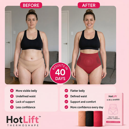 HotLift™ ThermoShape — Sauna-Effect Shorts with Thermal Compression and Active Microparticles